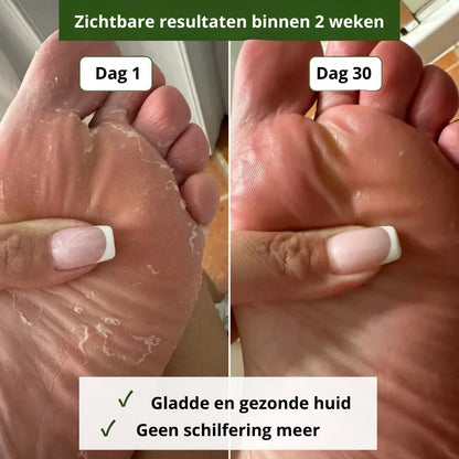 Zeep Tegen Schimmelinfecties
